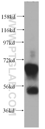 Synaptotagmin-1 Antibody in Western Blot (WB)