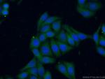 PSPH Antibody in Immunocytochemistry (ICC/IF)