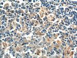 PSPH Antibody in Immunohistochemistry (Paraffin) (IHC (P))