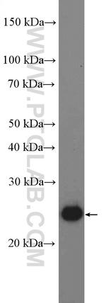 PSPH Antibody in Western Blot (WB)