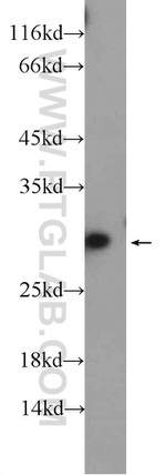 PSPH Antibody in Western Blot (WB)