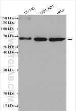 USP14 Antibody in Western Blot (WB)