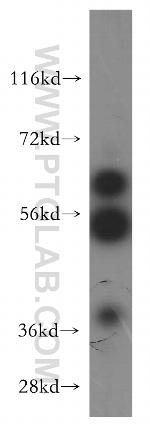 USP14 Antibody in Western Blot (WB)