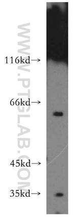 USP14 Antibody in Western Blot (WB)