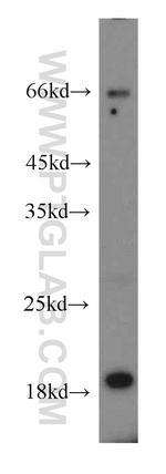 ENSA Antibody in Western Blot (WB)