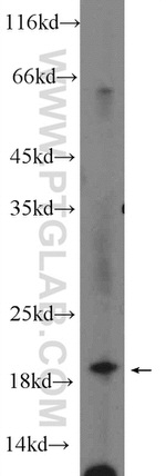 UBC12 Antibody in Western Blot (WB)