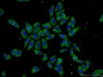 UBC12 Antibody in Immunocytochemistry (ICC/IF)