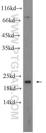 UBC12 Antibody in Western Blot (WB)