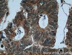 CRMP2 Antibody in Immunohistochemistry (Paraffin) (IHC (P))