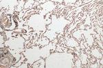 hnRNP-E1 Antibody in Immunohistochemistry (Paraffin) (IHC (P))