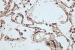 hnRNP-E1 Antibody in Immunohistochemistry (Paraffin) (IHC (P))