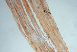 hnRNP-E1 Antibody in Immunohistochemistry (Paraffin) (IHC (P))