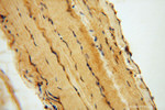 hnRNP-E1 Antibody in Immunohistochemistry (Paraffin) (IHC (P))