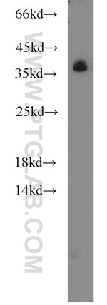 hnRNP-E1 Antibody in Western Blot (WB)