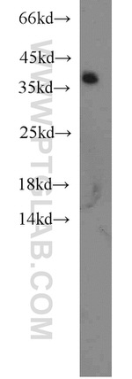 hnRNP-E1 Antibody in Western Blot (WB)