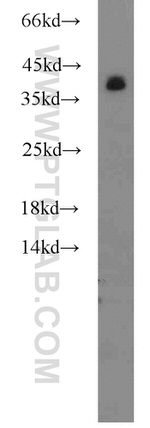 hnRNP-E1 Antibody in Western Blot (WB)
