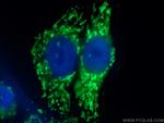 TOM70 Antibody in Immunocytochemistry (ICC/IF)