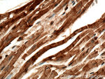 TOM70 Antibody in Immunohistochemistry (Paraffin) (IHC (P))