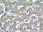 TOM70 Antibody in Immunohistochemistry (Paraffin) (IHC (P))