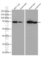 TOM70 Antibody in Western Blot (WB)