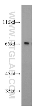 TOM70 Antibody in Western Blot (WB)