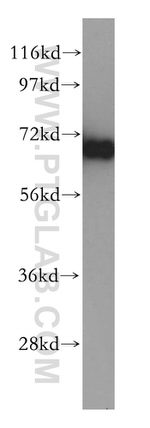 TOM70 Antibody in Western Blot (WB)