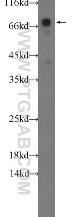 TOM70 Antibody in Western Blot (WB)