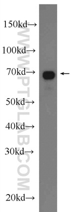 TOM70 Antibody in Western Blot (WB)