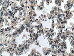 RGS4 Antibody in Immunohistochemistry (Paraffin) (IHC (P))