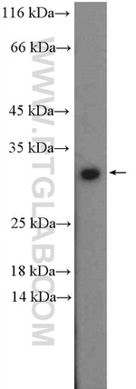 RGS4 Antibody in Western Blot (WB)