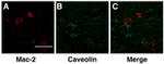 Galectin 3 Antibody in Immunohistochemistry (IHC)