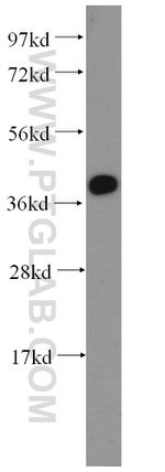 LAMR1/RPSA Antibody in Western Blot (WB)