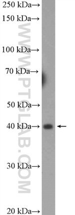 LAMR1/RPSA Antibody in Western Blot (WB)