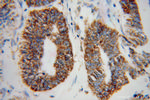 GSTK1 Antibody in Immunohistochemistry (Paraffin) (IHC (P))