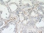 GSTK1 Antibody in Immunohistochemistry (Paraffin) (IHC (P))