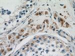 GSTK1 Antibody in Immunohistochemistry (Paraffin) (IHC (P))