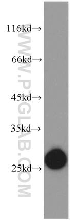 GSTK1 Antibody in Western Blot (WB)