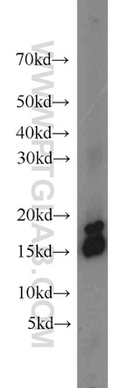 Hemoglobin alpha Antibody in Western Blot (WB)