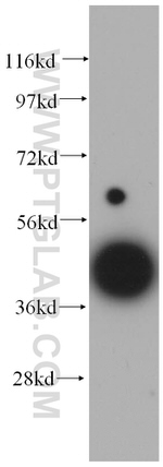 TCP10 Antibody in Western Blot (WB)