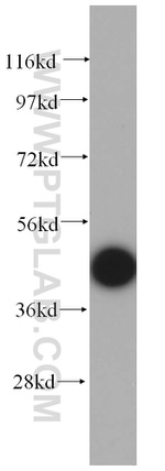 TCP10 Antibody in Western Blot (WB)