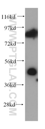 TCP10 Antibody in Western Blot (WB)