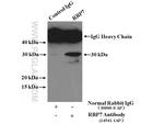 RBP7 Antibody in Immunoprecipitation (IP)