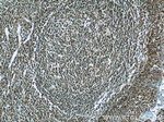 LMP2 Antibody in Immunohistochemistry (Paraffin) (IHC (P))