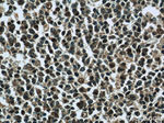 LMP2 Antibody in Immunohistochemistry (Paraffin) (IHC (P))