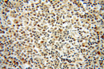 LMP2 Antibody in Immunohistochemistry (Paraffin) (IHC (P))