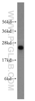 MSRA Antibody in Western Blot (WB)