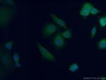 AFP Antibody in Immunocytochemistry (ICC/IF)