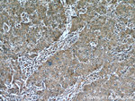 AFP Antibody in Immunohistochemistry (Paraffin) (IHC (P))