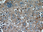 AFP Antibody in Immunohistochemistry (Paraffin) (IHC (P))