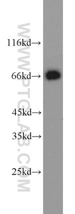 AFP Antibody in Western Blot (WB)